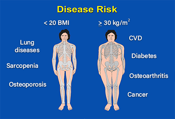Photo: Weight related health risks figure.